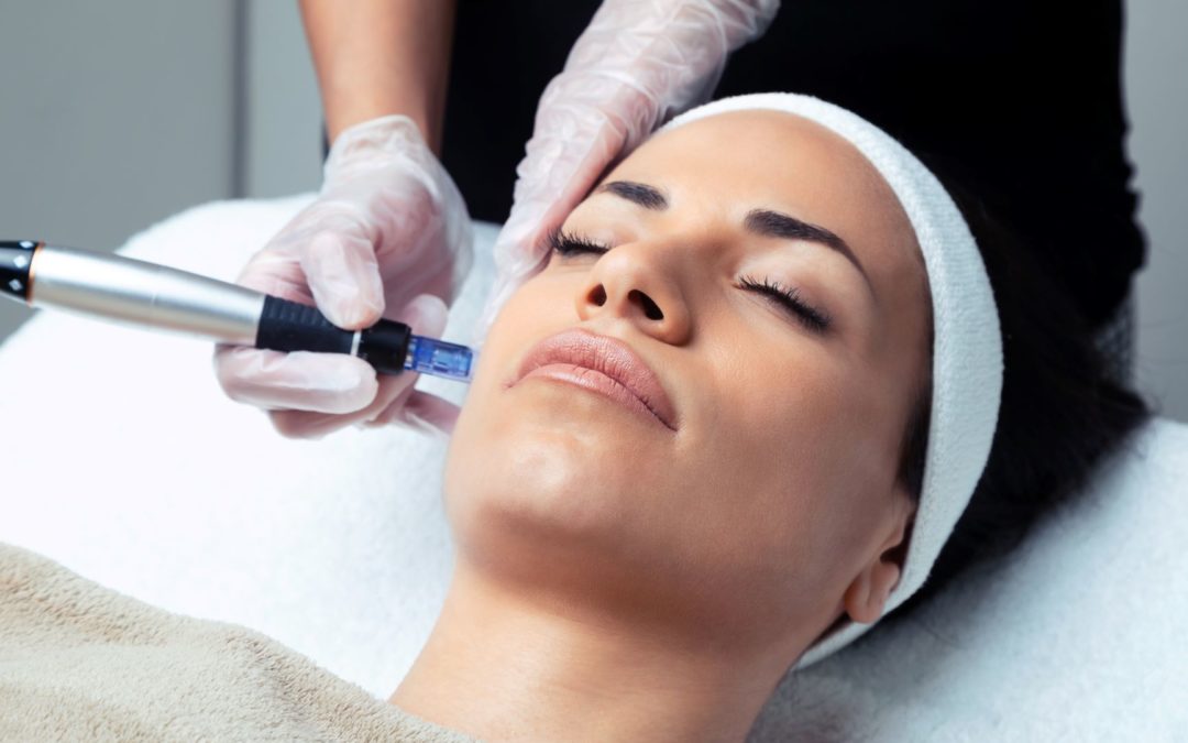 What Is a Vampire Facial? What You Need to Know About Microneedling With PRP (Platelet Rich Plasma)