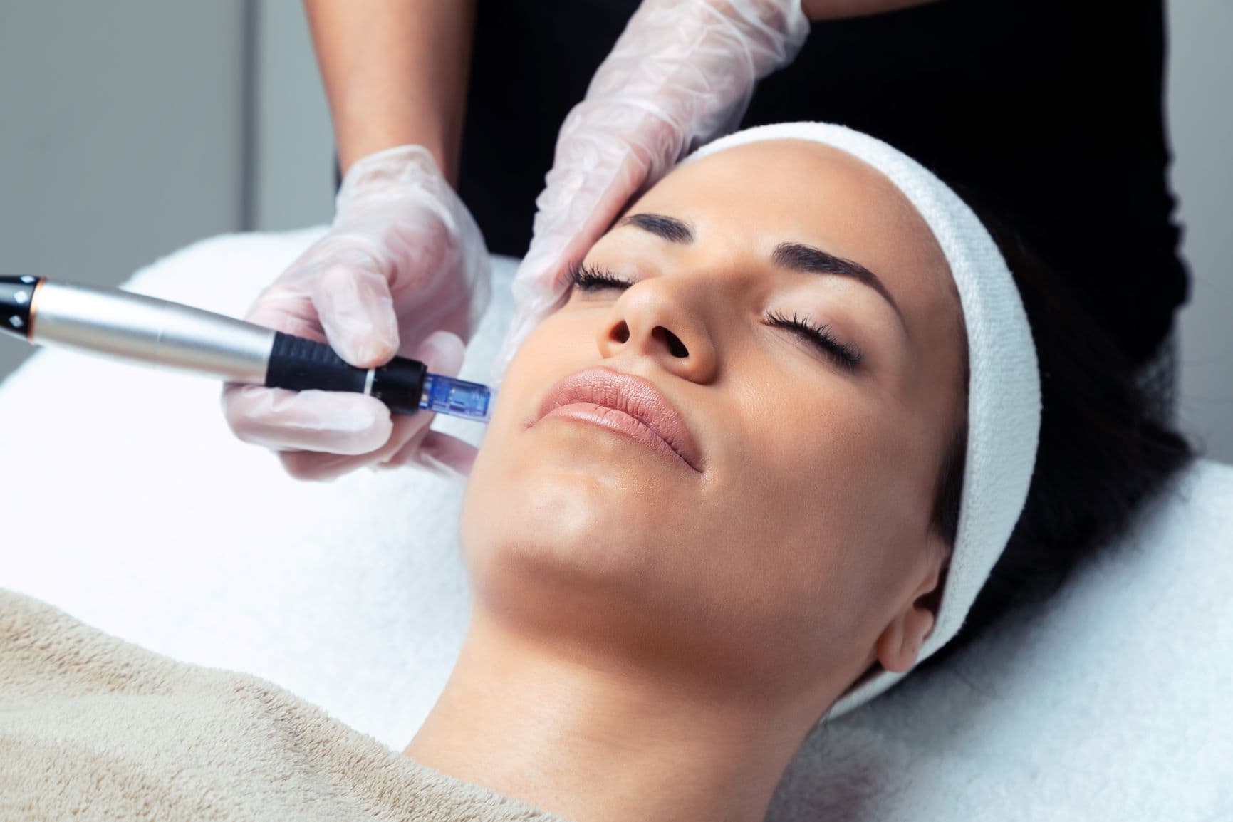 What Is a Vampire Facial? What You Need to Know About Microneedling With PRP (Platelet Rich Plasma)