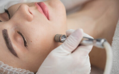What Are the Benefits of Microdermabrasion?