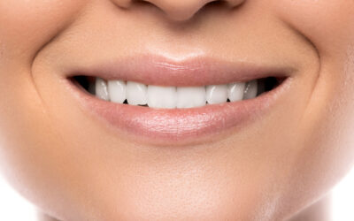 Get a Brighter Smile: The Top 5 Benefits of Teeth Whitening